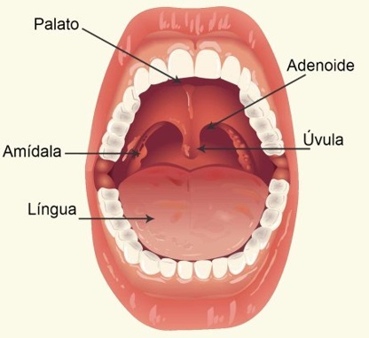 amigdalas-tonsilas-palatinas