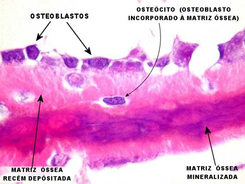 osteoblastos
