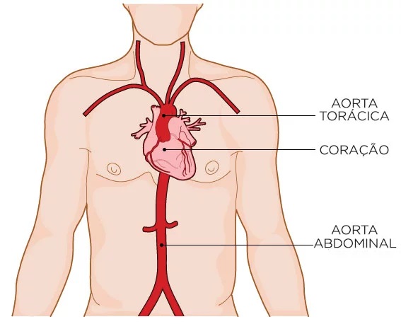 artéria-aorta