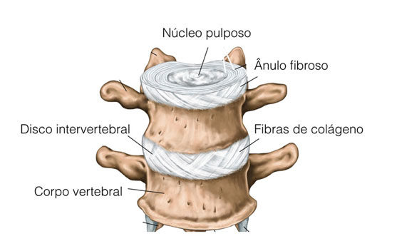 disco-intervertebral-espinha-dorsal